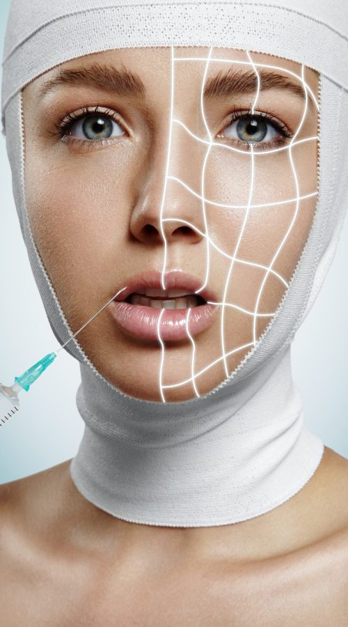 woman in a process of increase her lips and with lines on her face